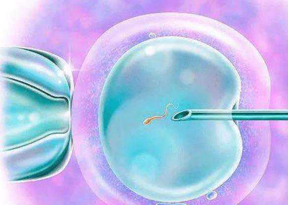 染色体异常致胎停_切除女孩子宫_试管婴儿停药三四天后发现怀孕了怎么办 是移