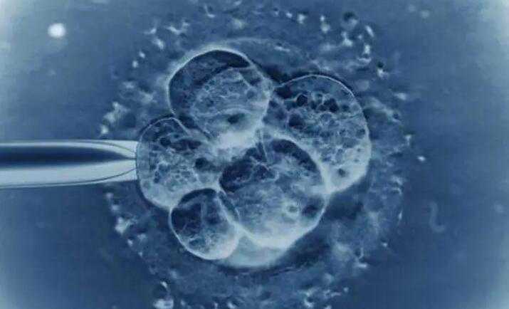 体外射精会怀孕吗_试管后染色体异常_女性做试管婴儿对身体伤害有多大?看看医